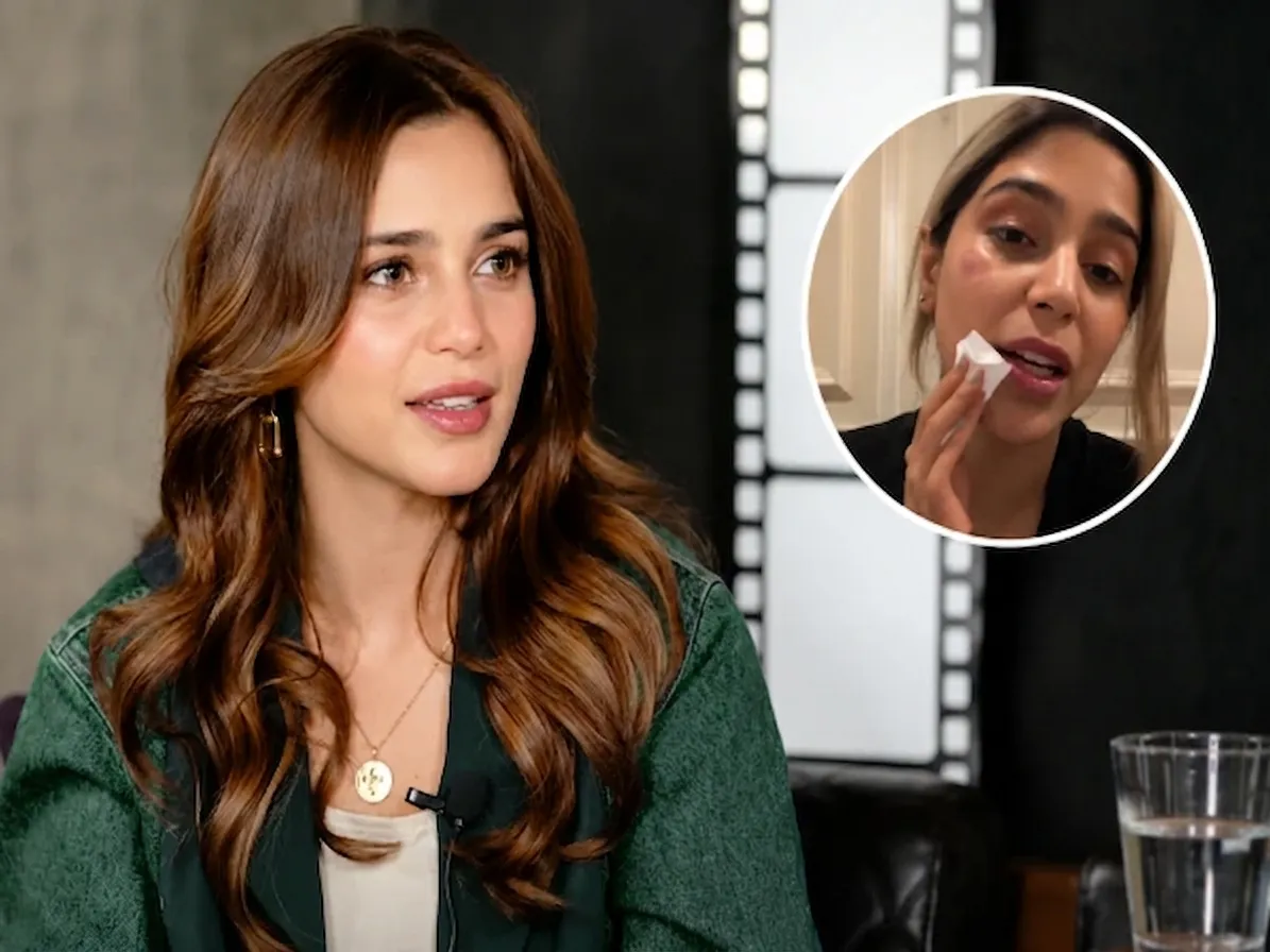 Aima Baig was injured in the face and around the eye after hitting a door
